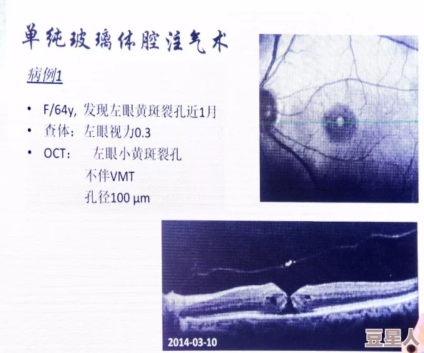 双性花蒂尿孔bl：科学家发现新型植物生殖结构，揭示其在生态系统中的重要作用与潜在应用价值