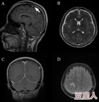 女性在巅峰时期抽搐的原因：科学家发现惊人真相，或与生活方式和心理压力密切相关！